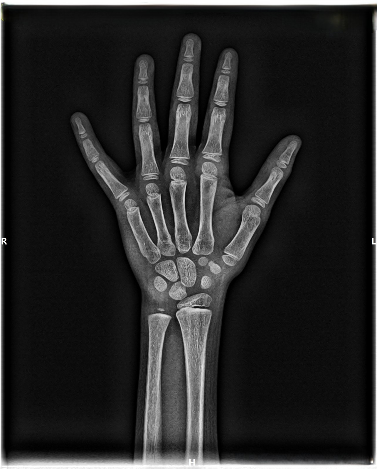 Hand Wrist